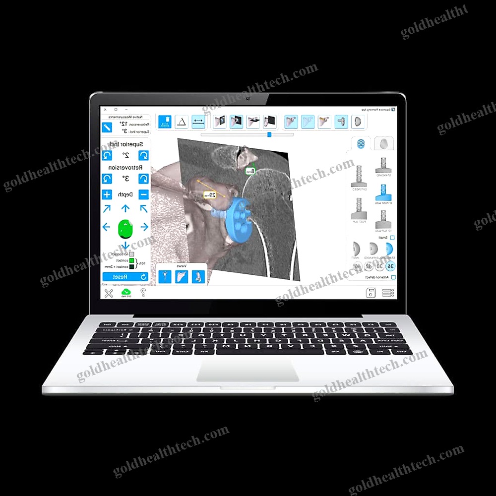 Shoulder Prosthesis Positioning Surgical Navigation System