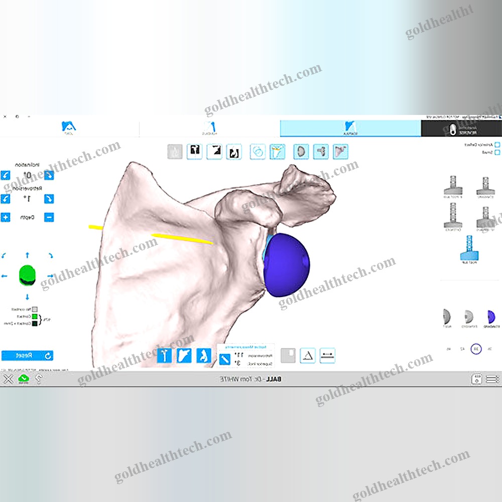Shoulder Prosthesis Positioning Surgical Navigation System