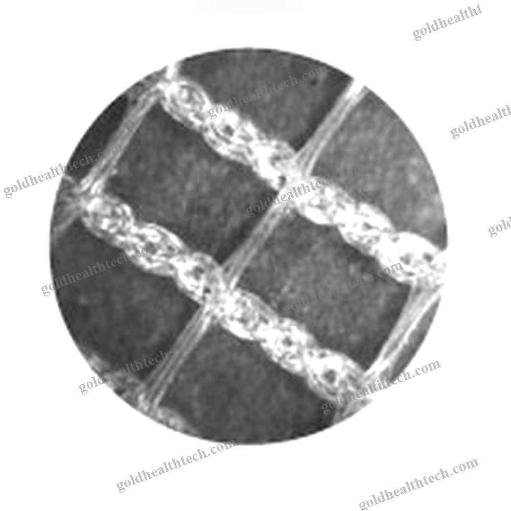 Abdominal Hernia Prosthesis