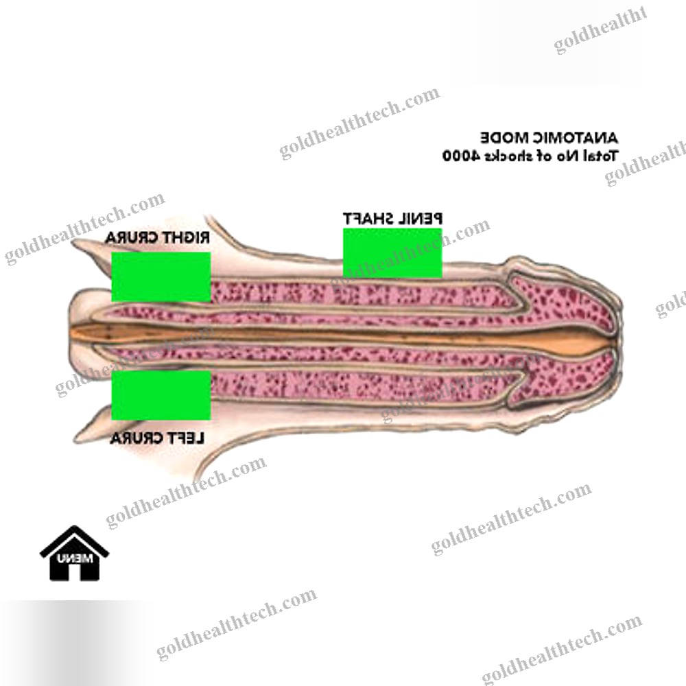 Erectile Dysfunction Eswt Unit