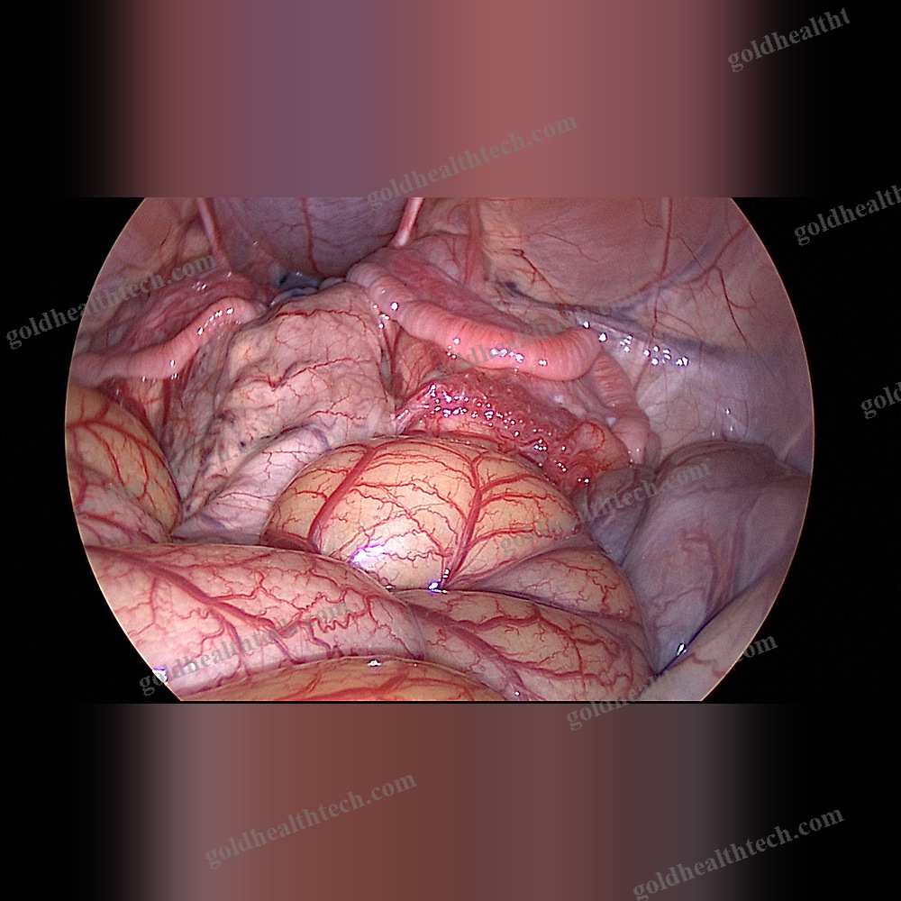 Universal Software
