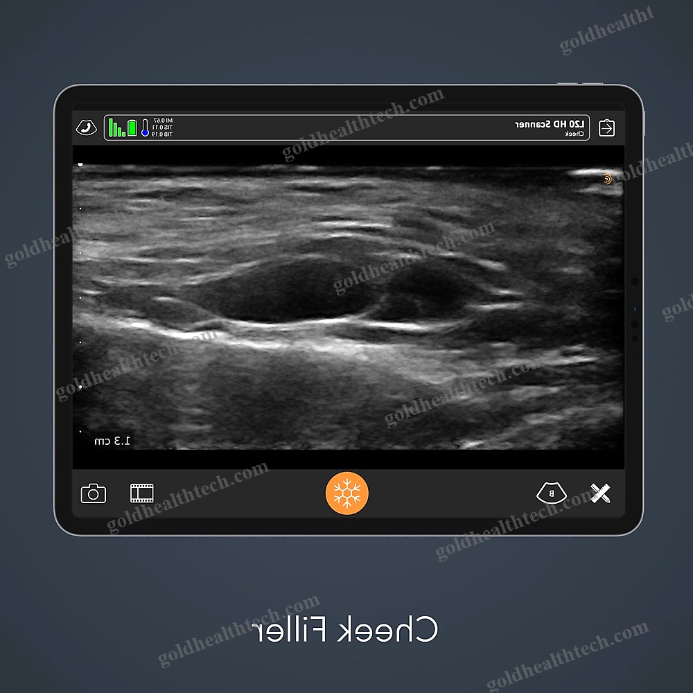Hand-Held Ultrasound System