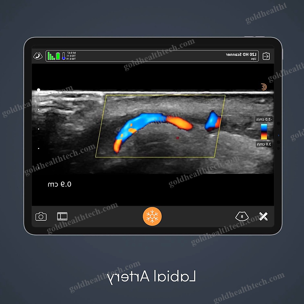 Hand-Held Ultrasound System