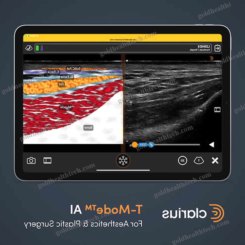 Hand-Held Ultrasound System