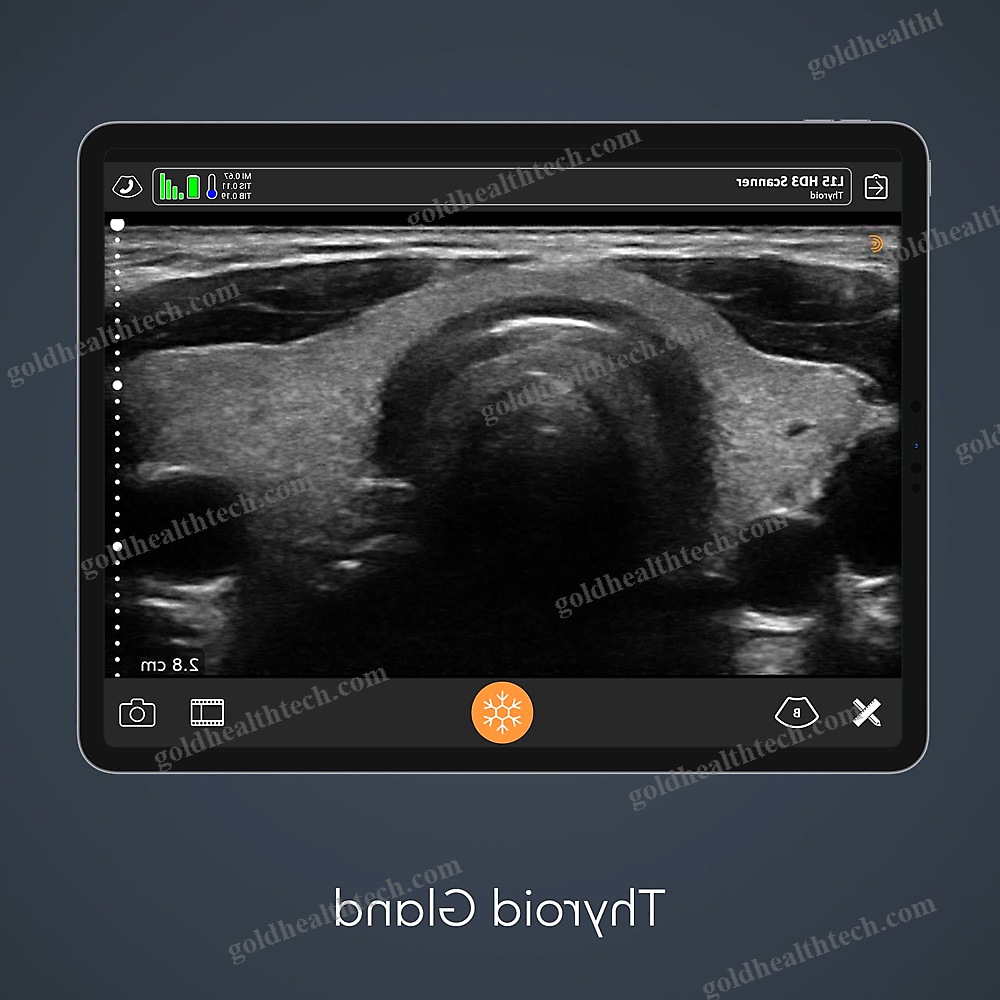 Hand-Held Ultrasound System