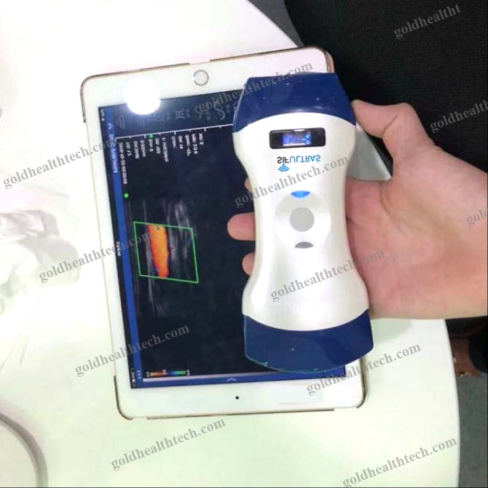 Hand-Held Ultrasound System