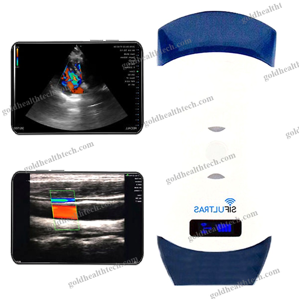 Hand-Held Ultrasound System