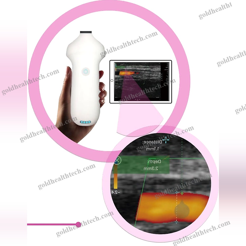 Hand-Held Ultrasound System