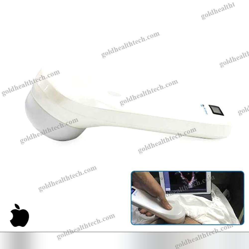 Hand-Held Bladder Scanner