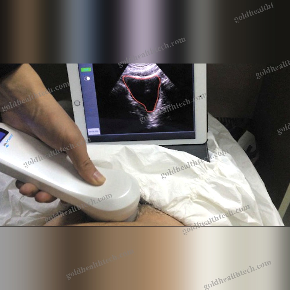 Portable Ultrasound Bladder Scanner