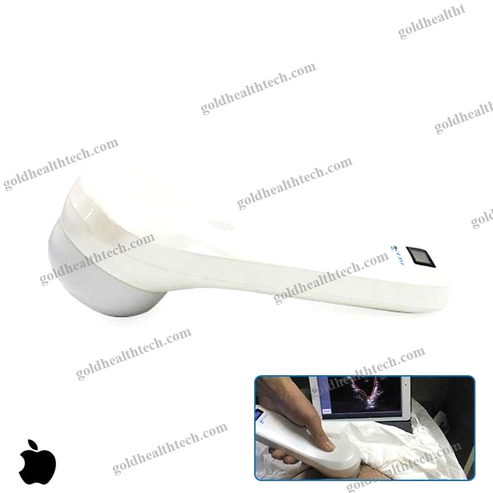 Portable Ultrasound Bladder Scanner