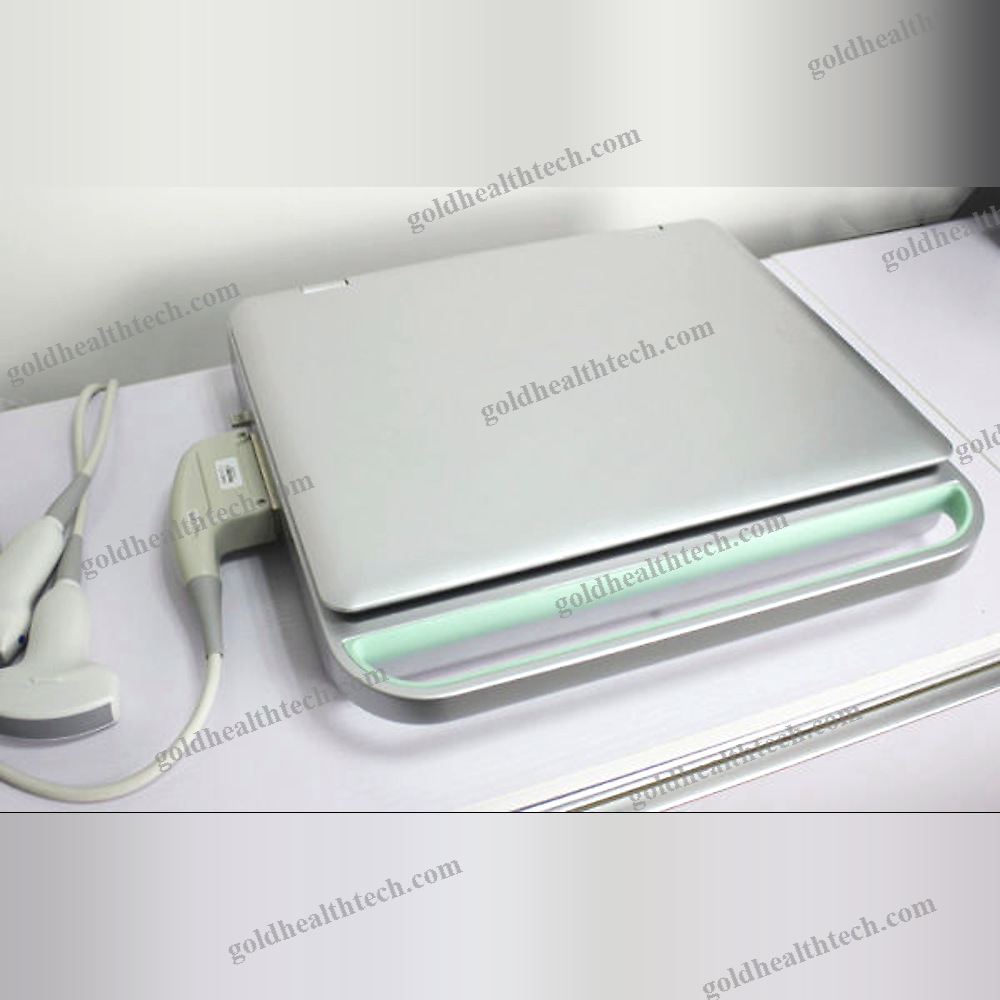 Portable Ultrasound System