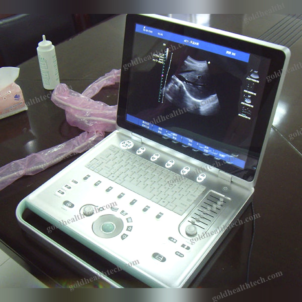 Portable Ultrasound System