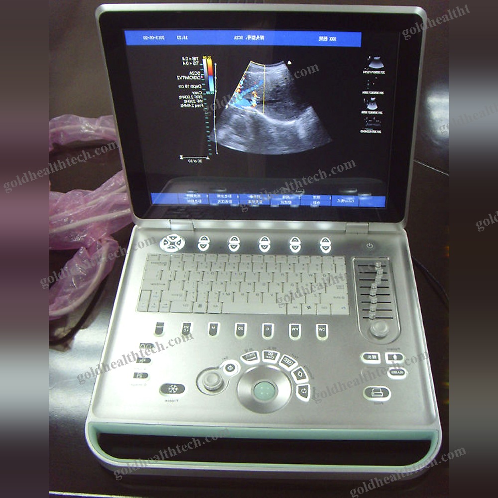 Portable Ultrasound System