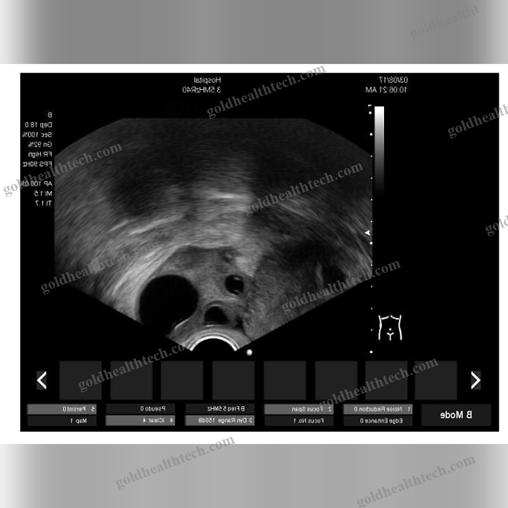 On-Platform Ultrasound System
