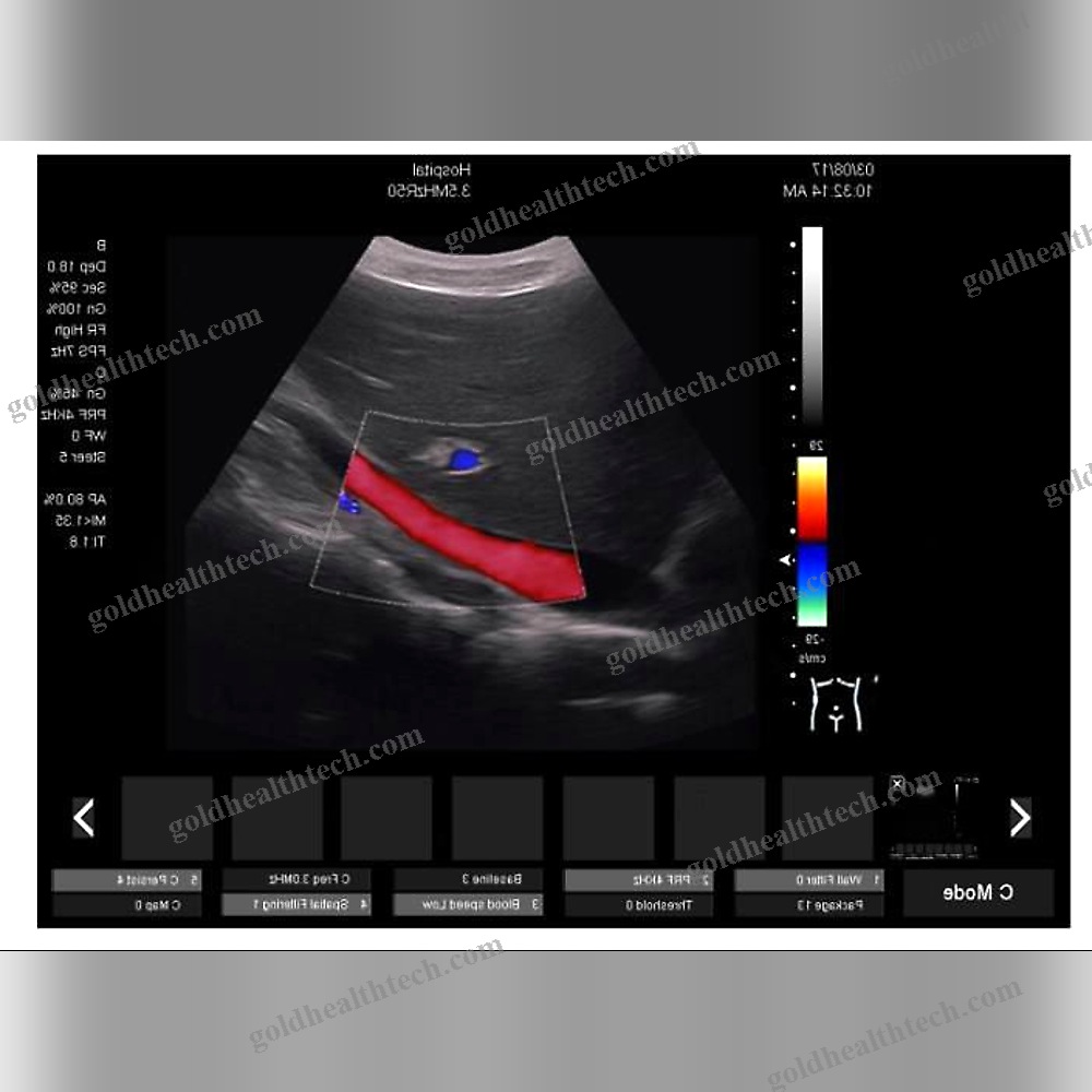 On-Platform Ultrasound System