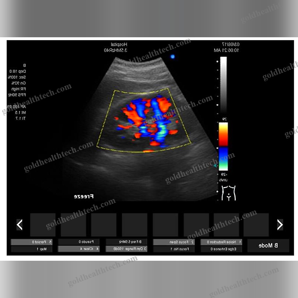 On-Platform Ultrasound System