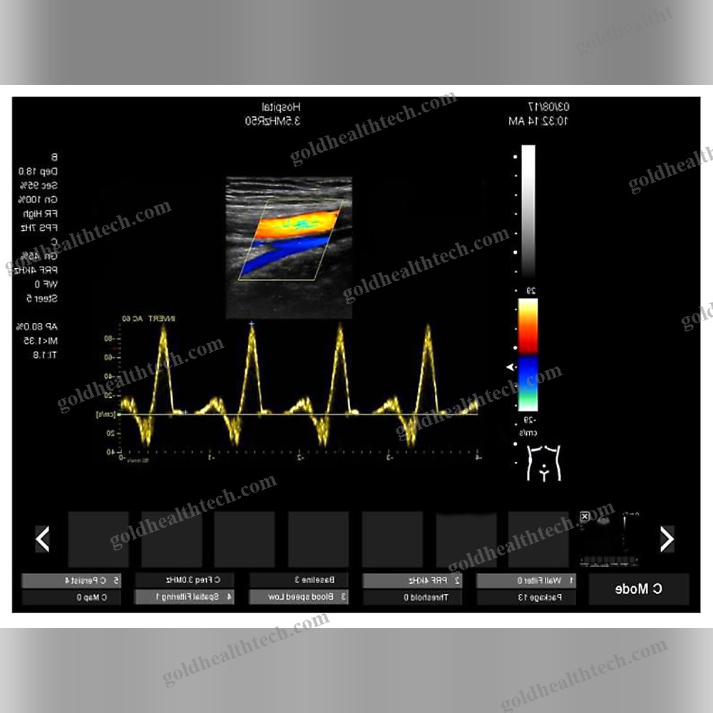 On-Platform Ultrasound System