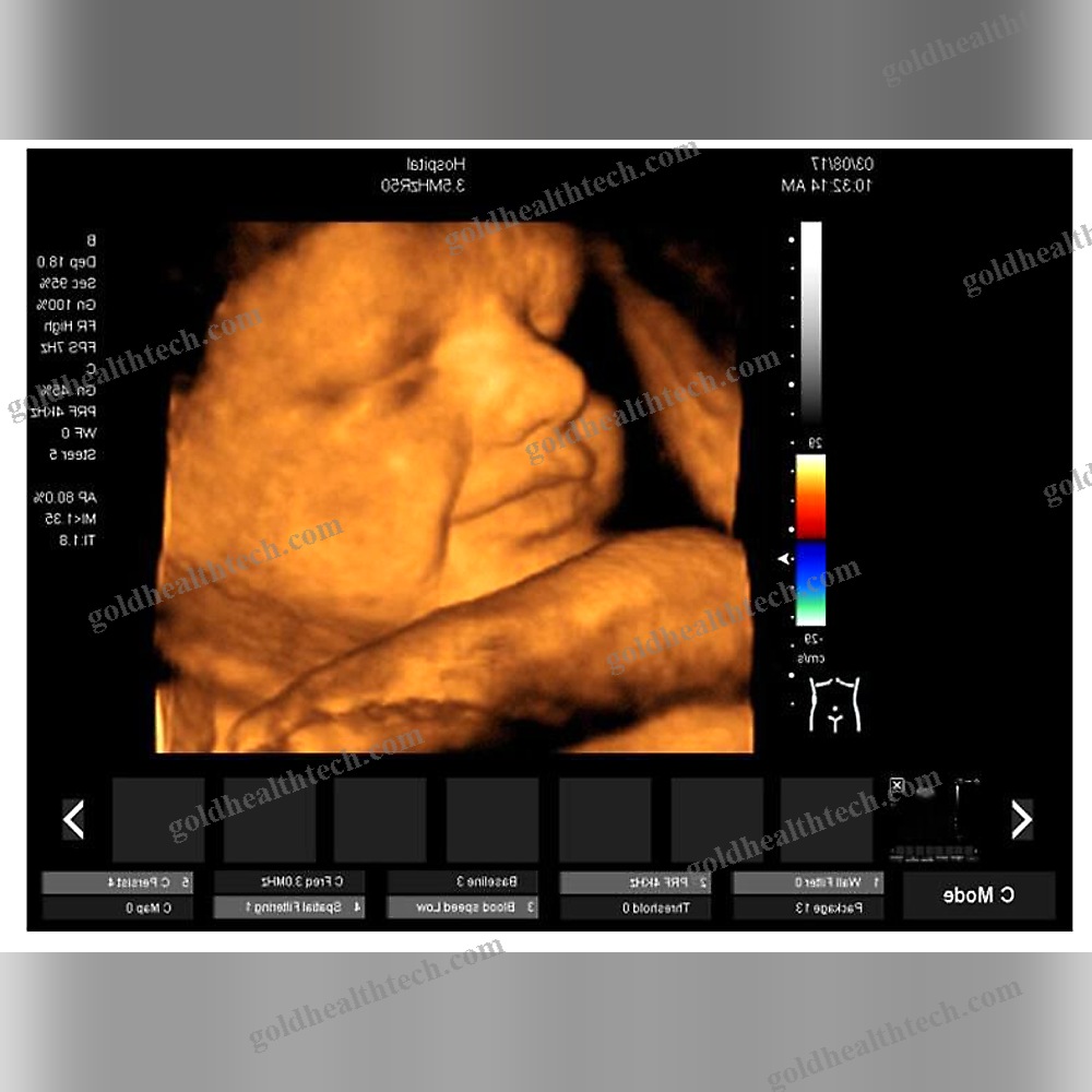On-Platform Ultrasound System