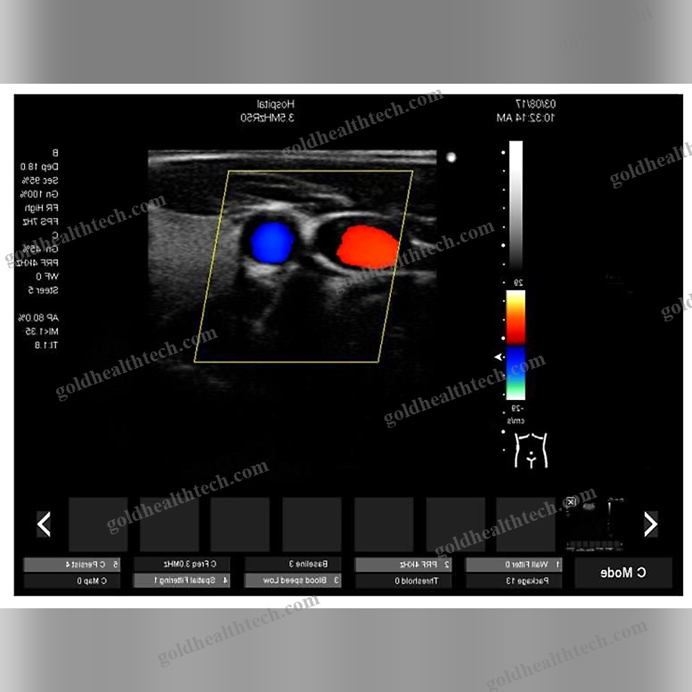 On-Platform Ultrasound System