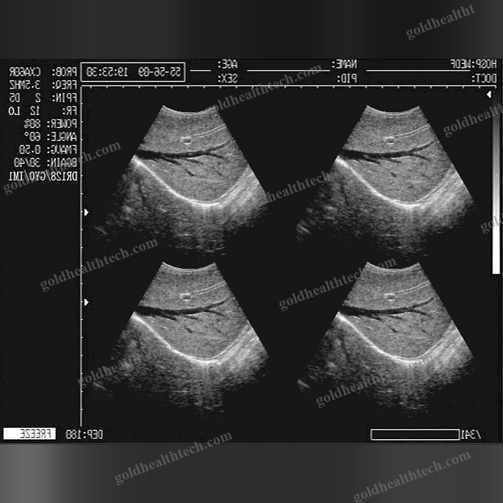 On-Platform Ultrasound System