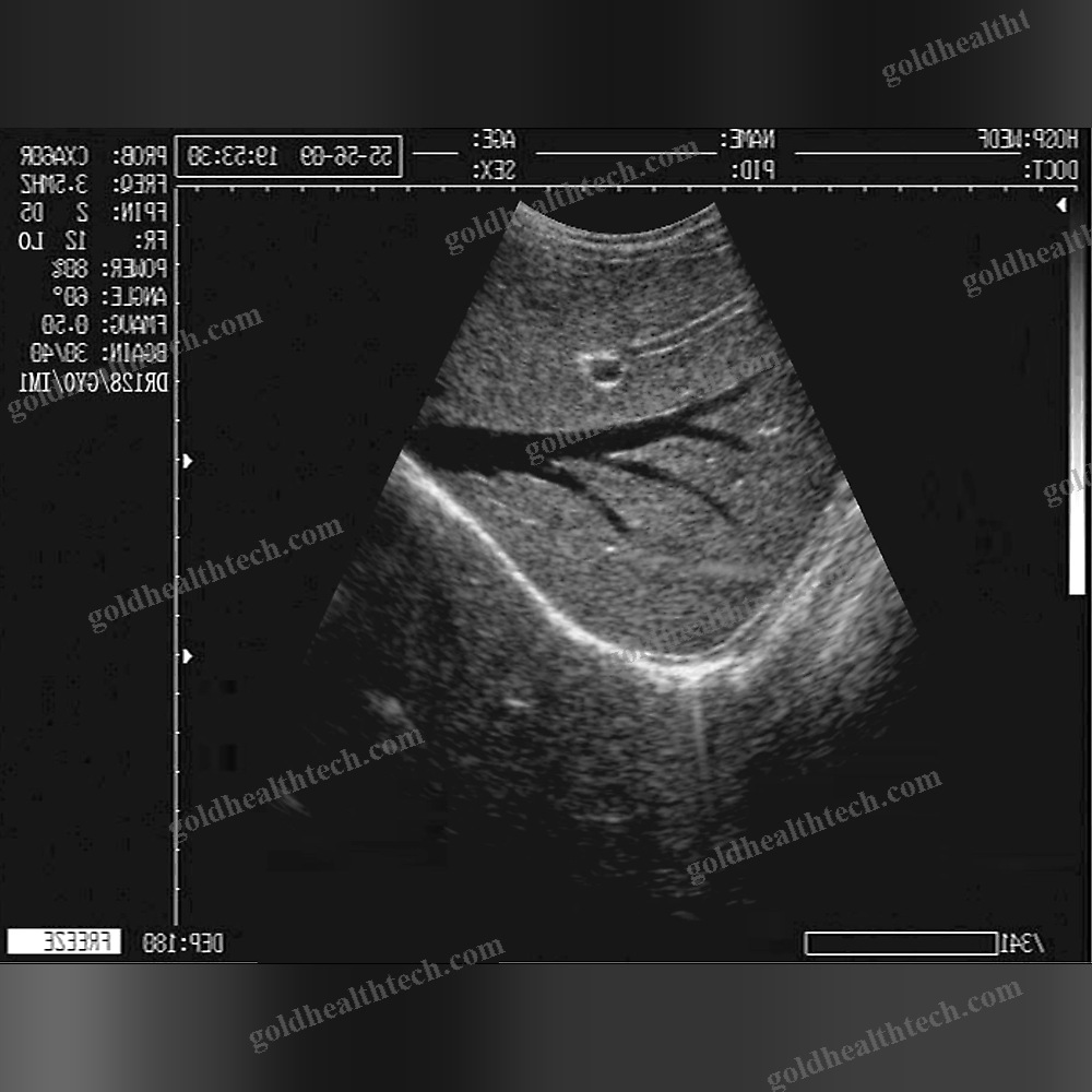 On-Platform Ultrasound System