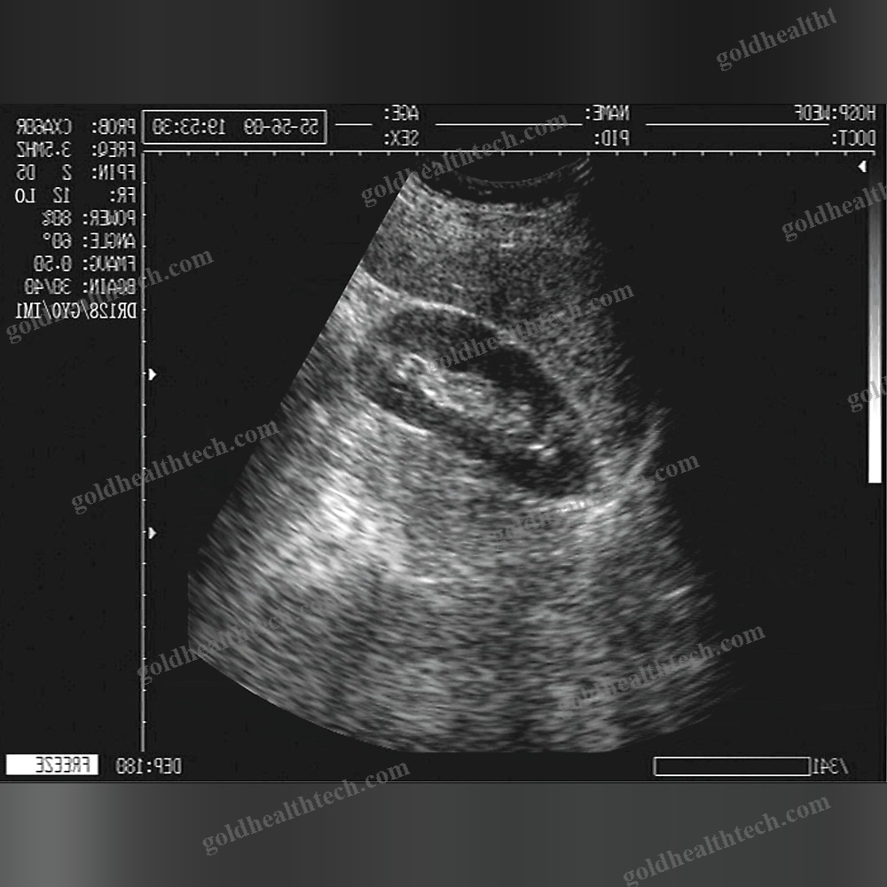 On-Platform Ultrasound System