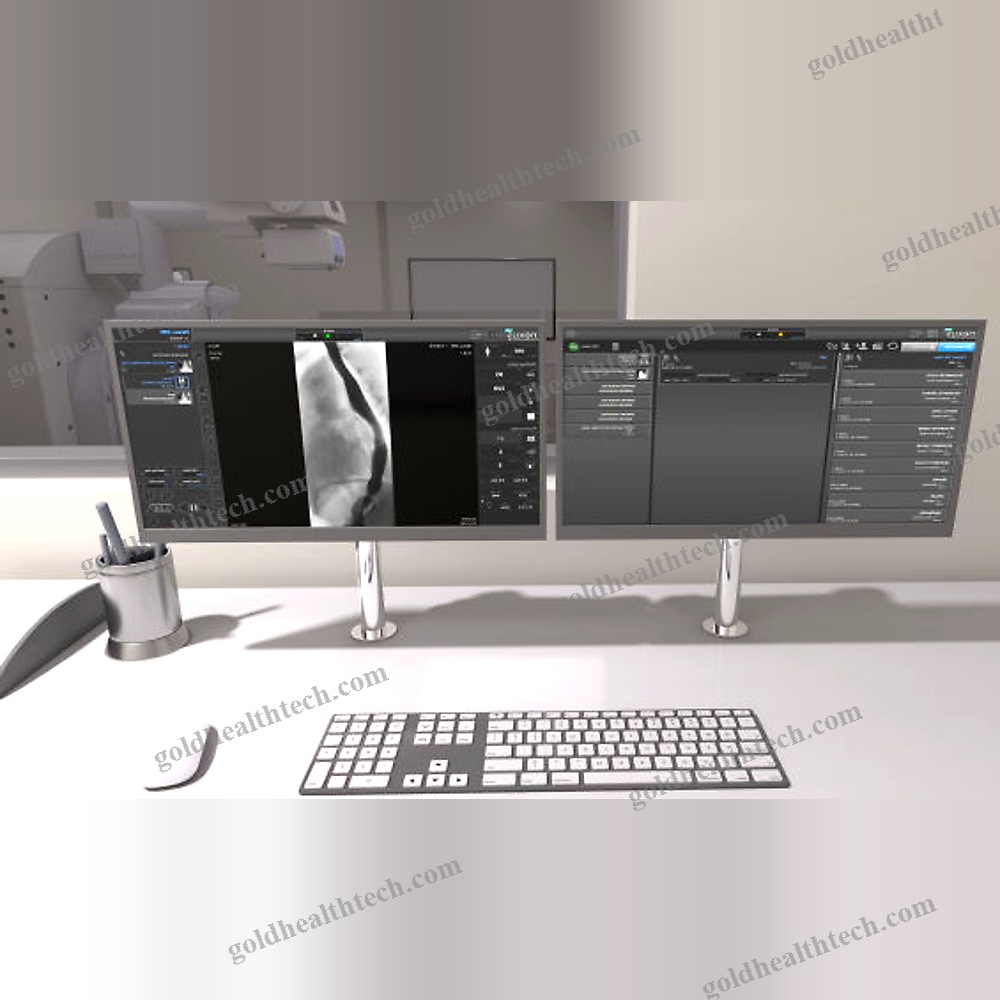 Fluoroscopy Acquisition System