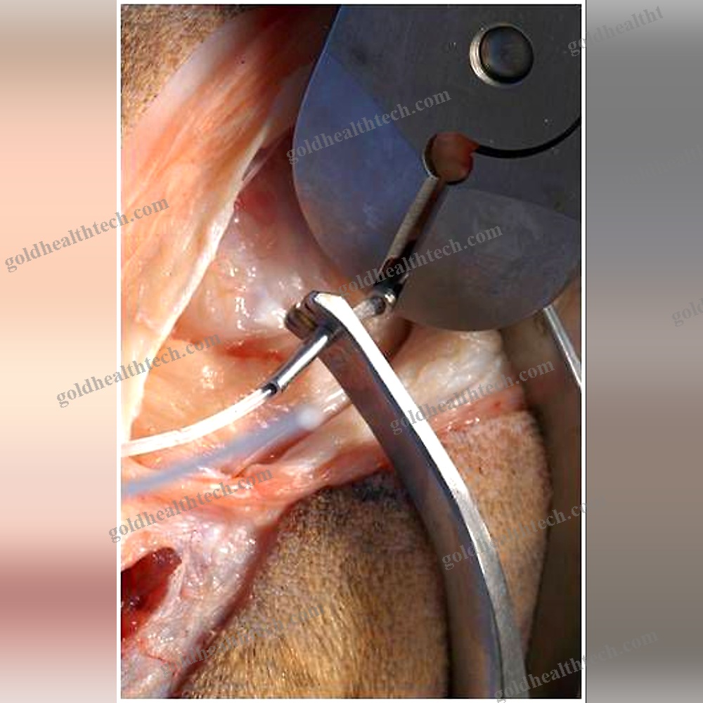 Veterinary Orthopedy Forceps