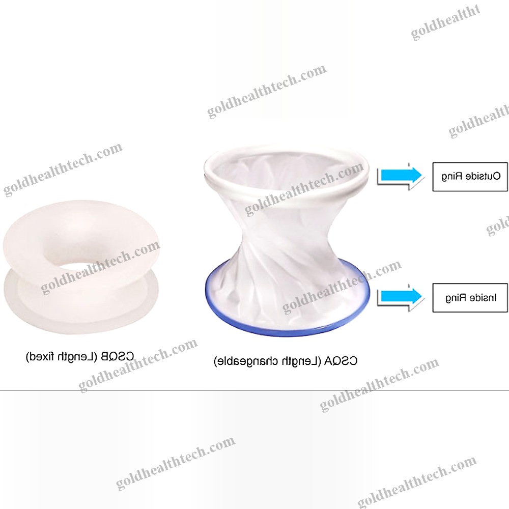 Wound Retractor