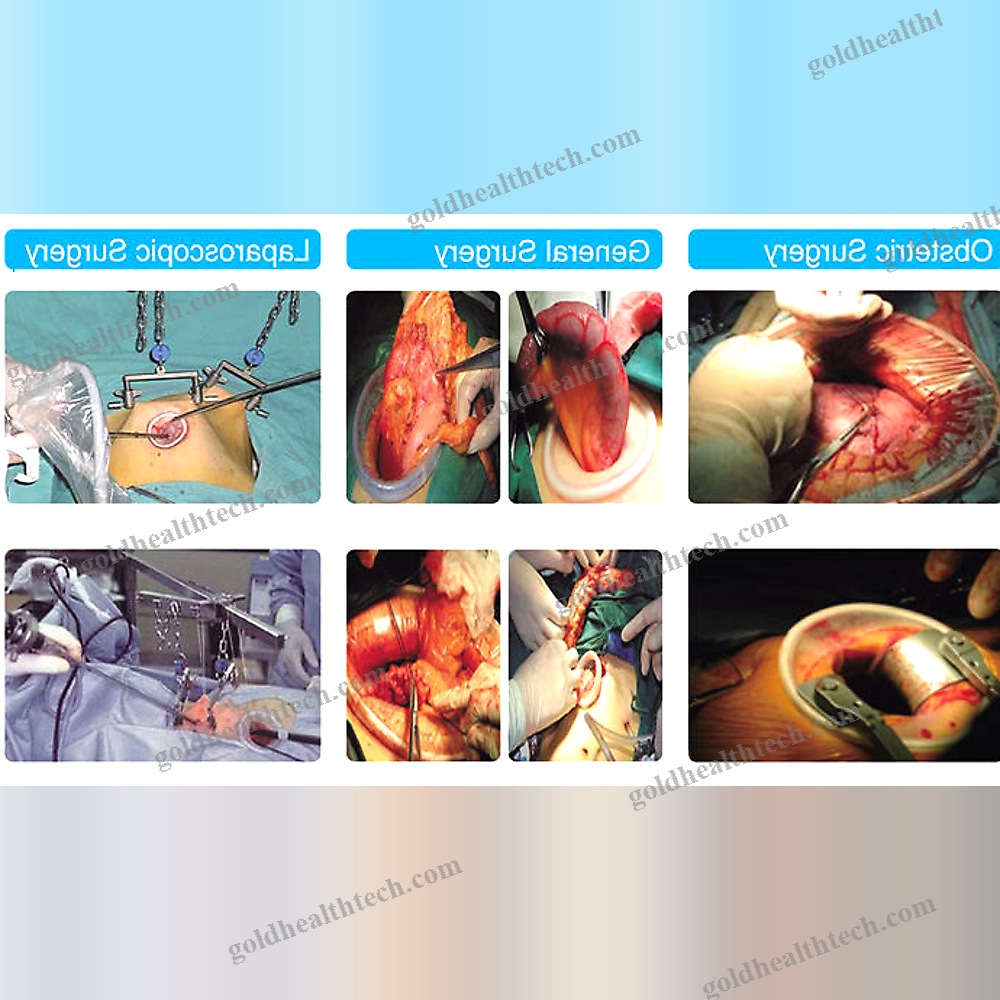 Wound Retractor