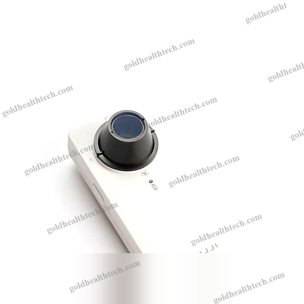 White Led Dermatoscope