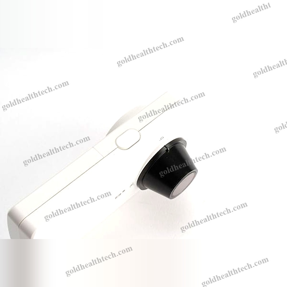 White Led Dermatoscope
