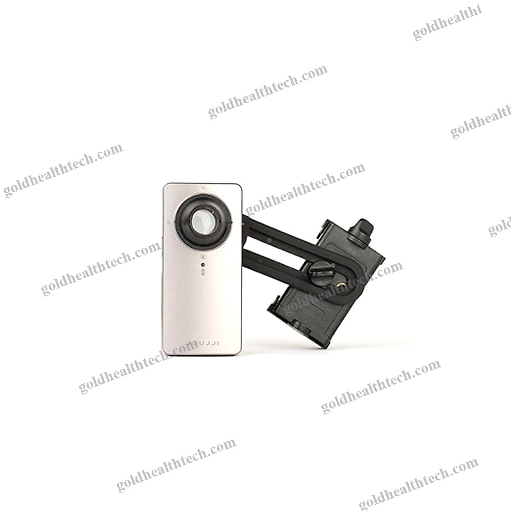 White Led Dermatoscope