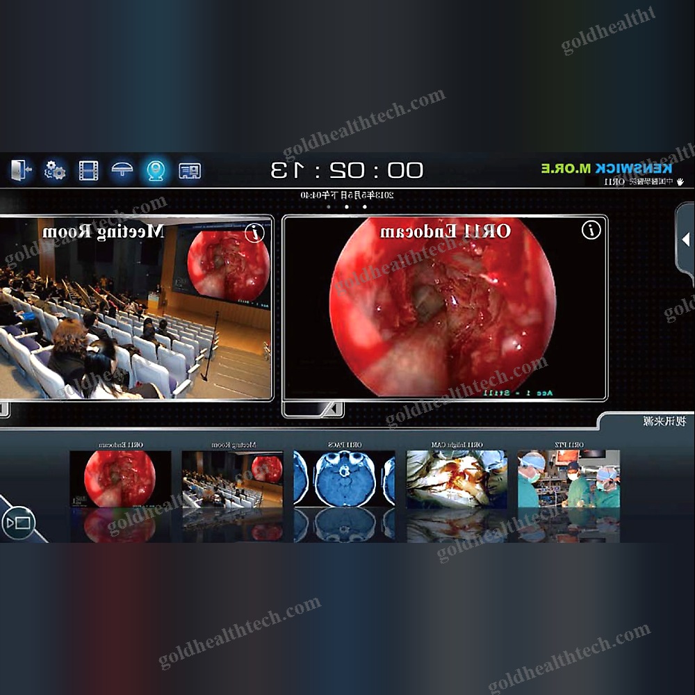 Or Video System