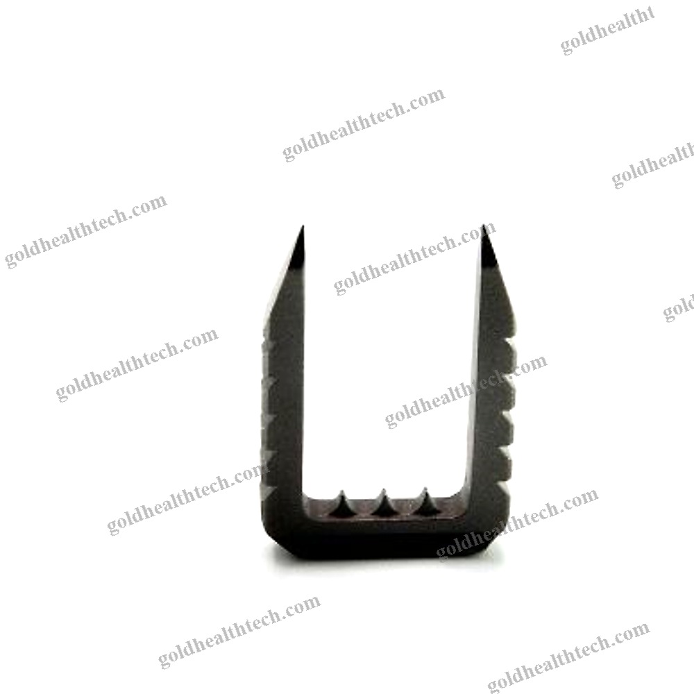 Knee Ligamentoplasty Bone Staple