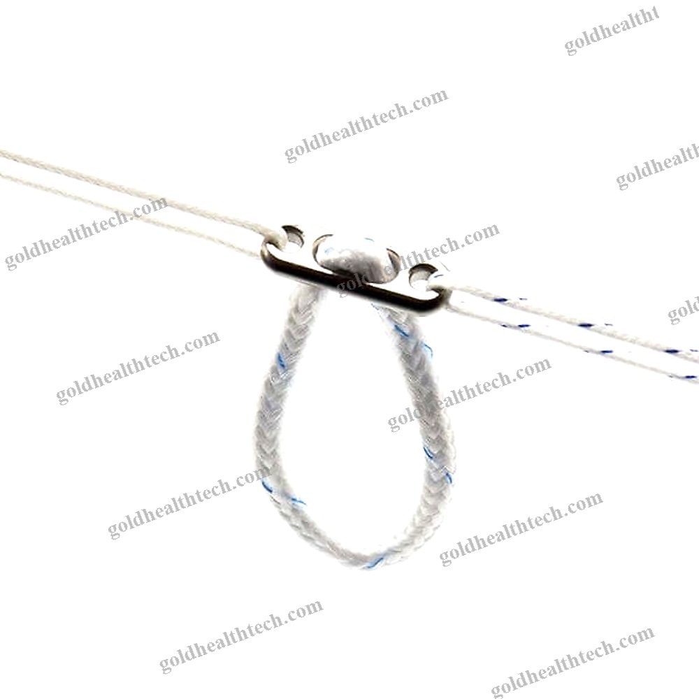 Acl Reconstruction Suture Button