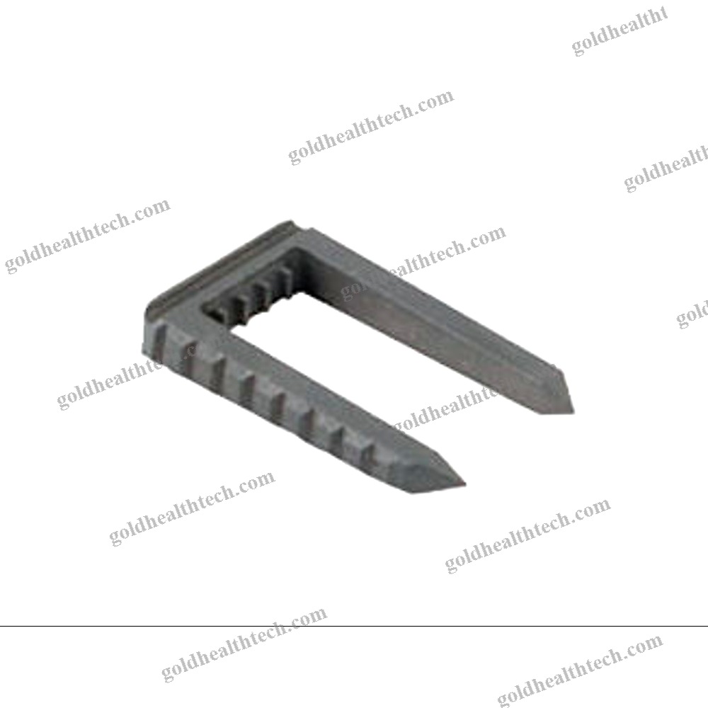 Knee Ligamentoplasty Bone Staple