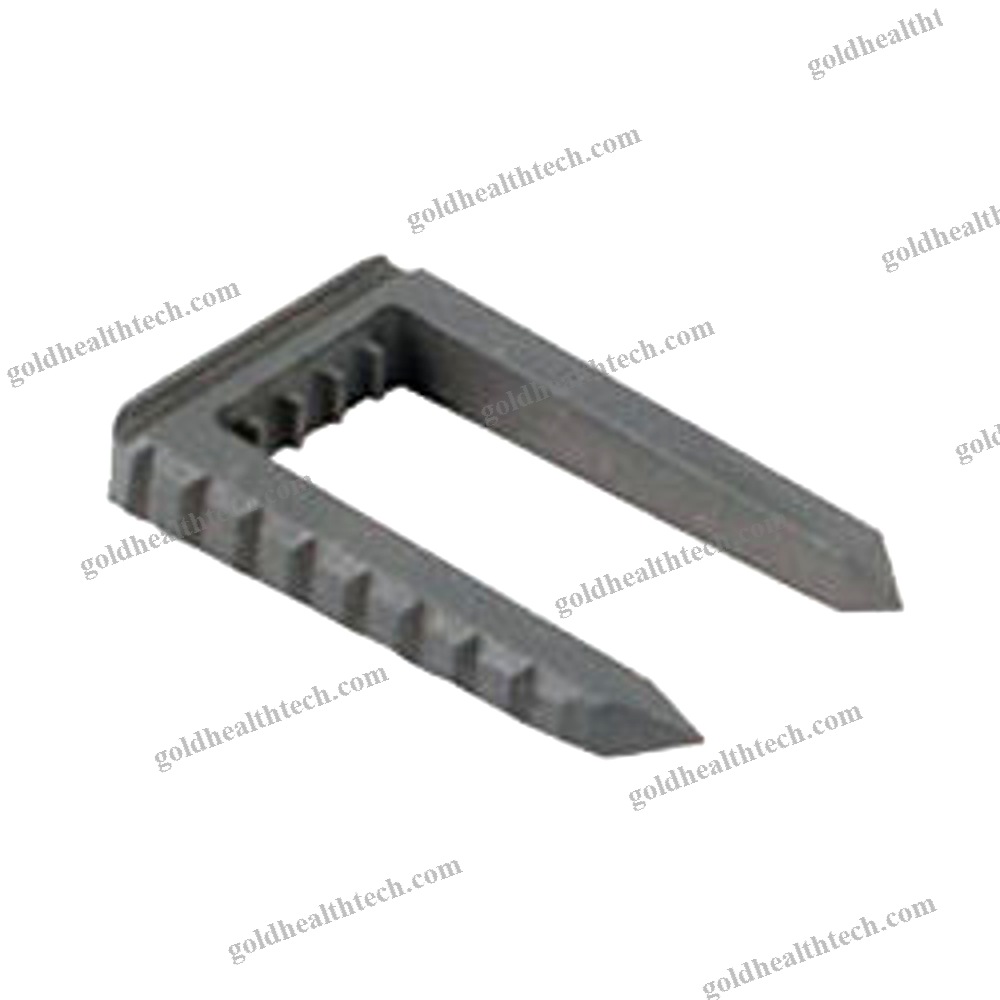 Knee Ligamentoplasty Bone Staple