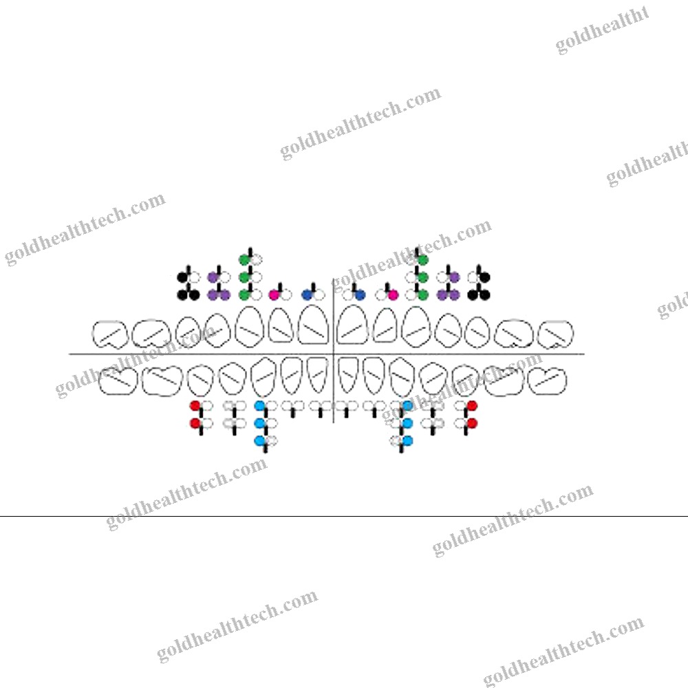 Metal Orthodontic Bracket