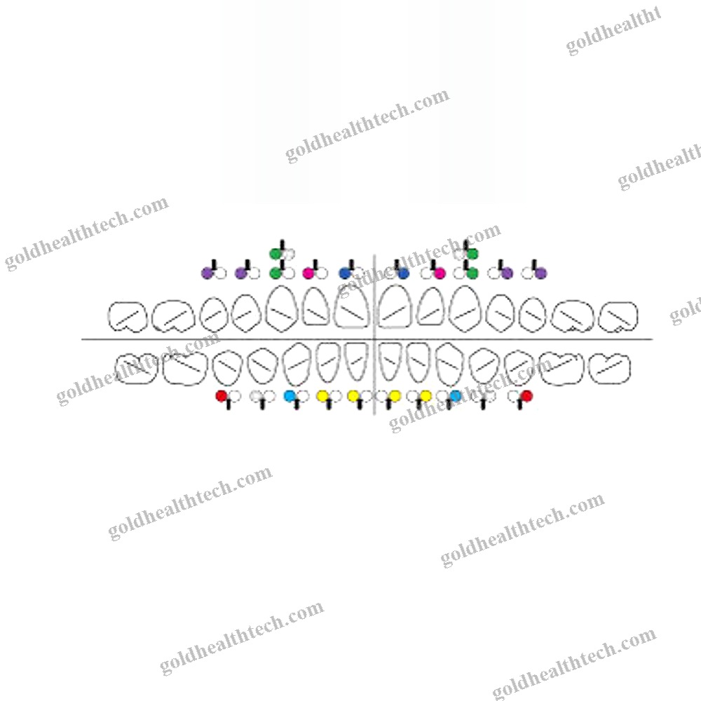 Metal Orthodontic Bracket