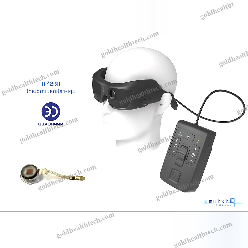 Epiretinal Implant