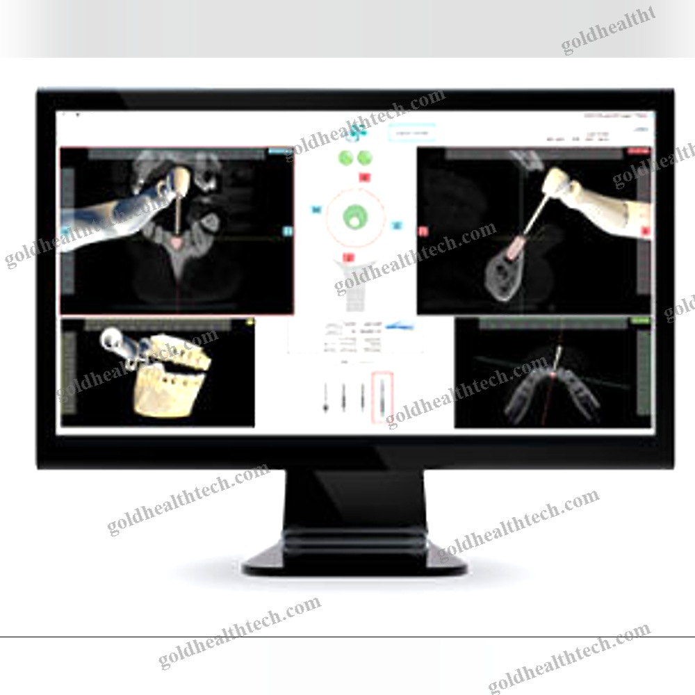 Dental Surgery Surgical Navigation System