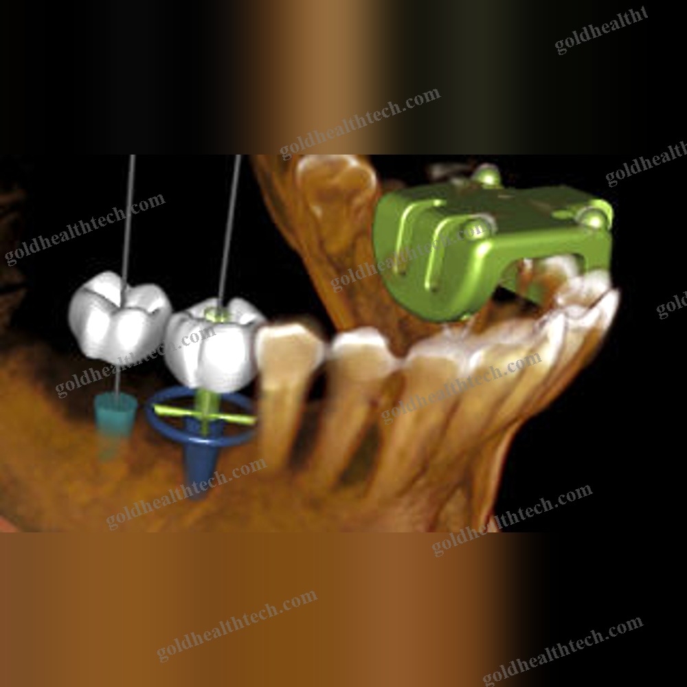 Dental Surgery Surgical Navigation System