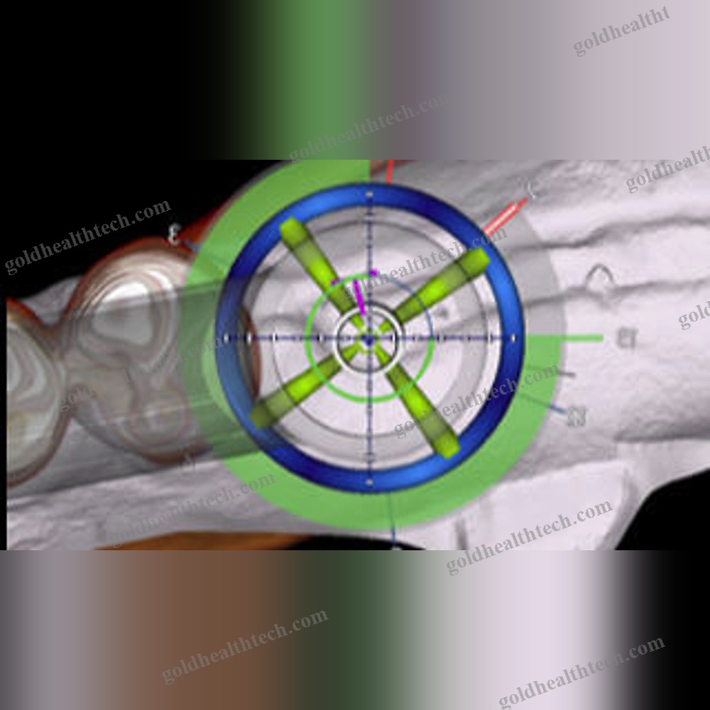 Dental Surgery Surgical Navigation System