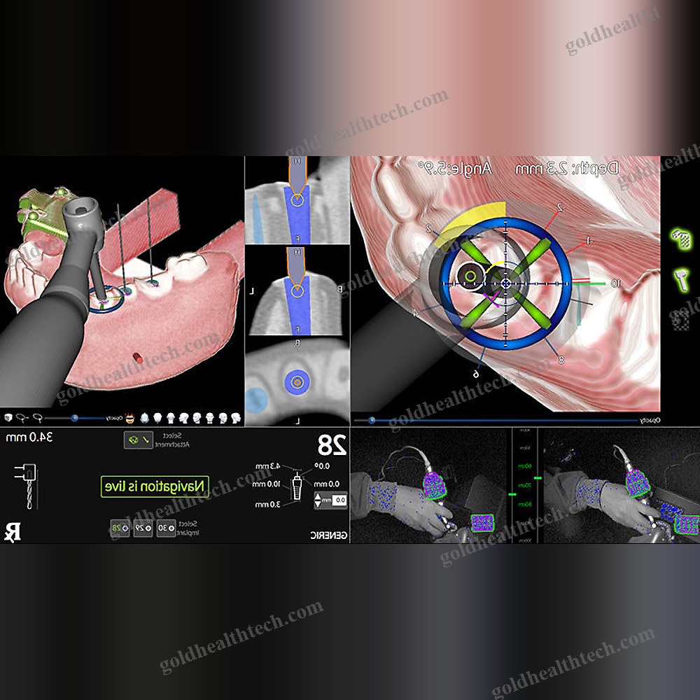 Dental Surgery Surgical Navigation System