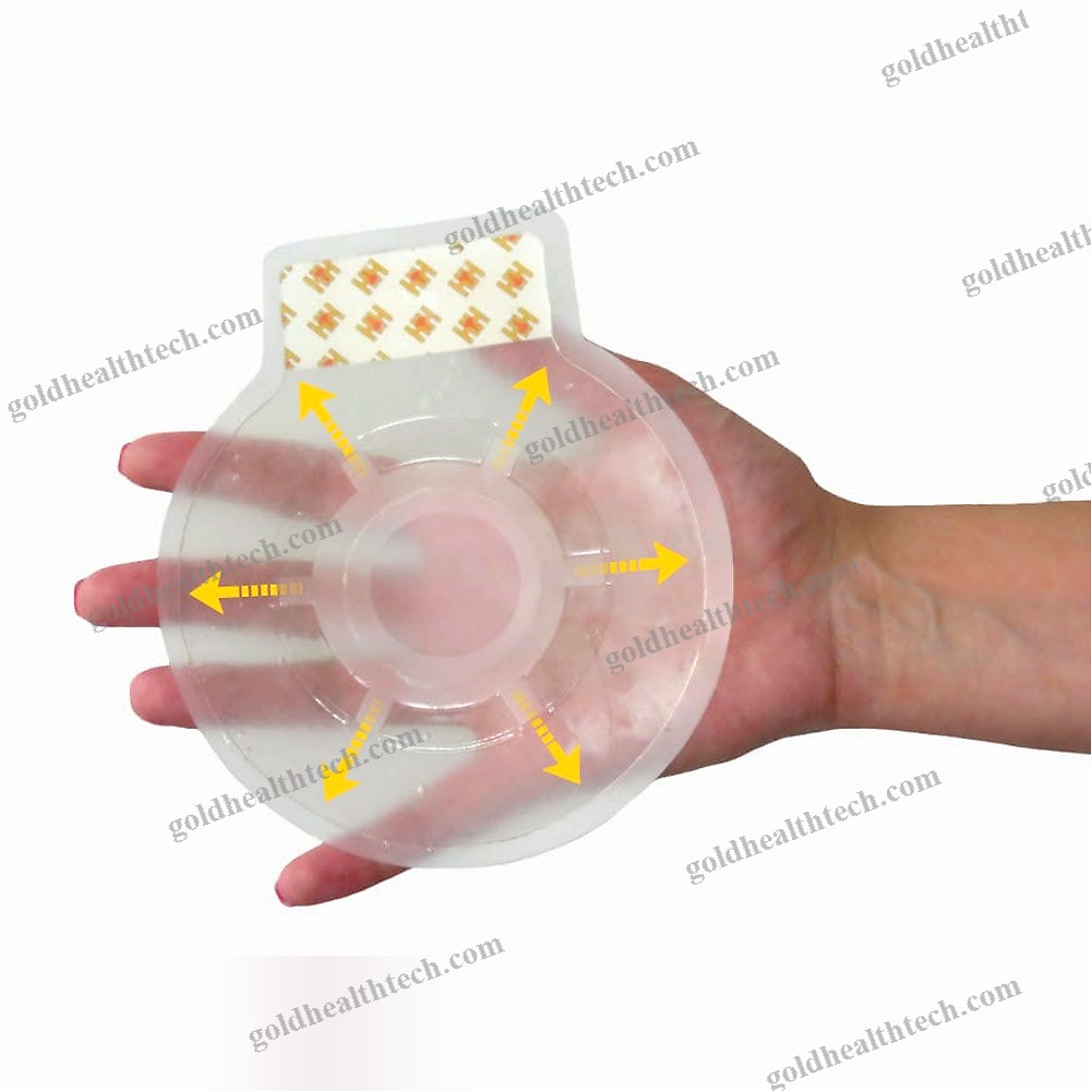 Wound Dressing