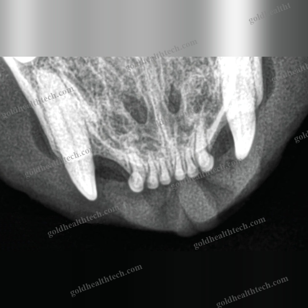 Veterinary Intra-Oral Detector