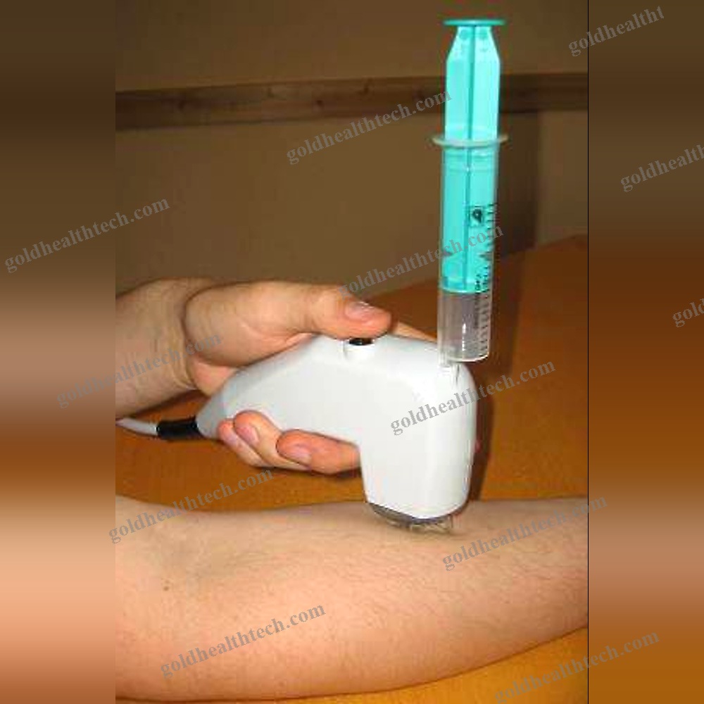 On-Platform, Tabletop Ultrasound System