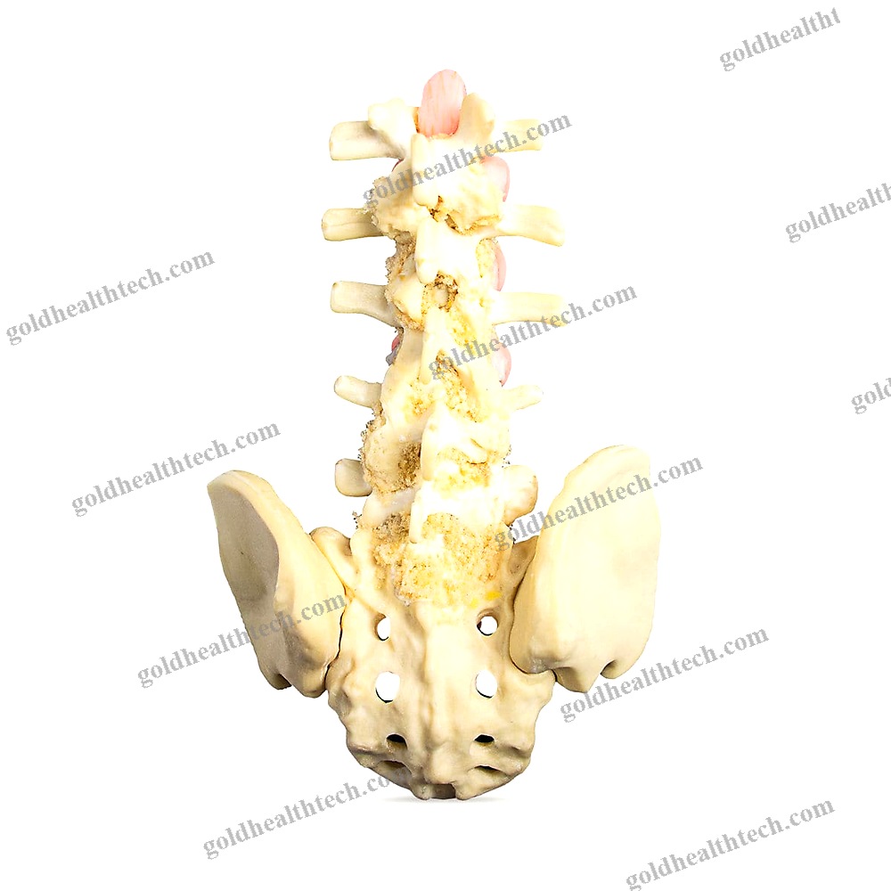 Lumbar Puncture Patient Simulator